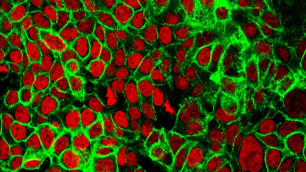intracellular Imaging
